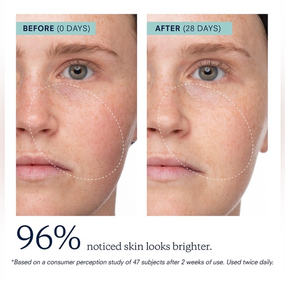 KORA Organics Turmeric BHA Pore & Brightening Treatment Mask (10ml) mini size - Picture 3 of 5